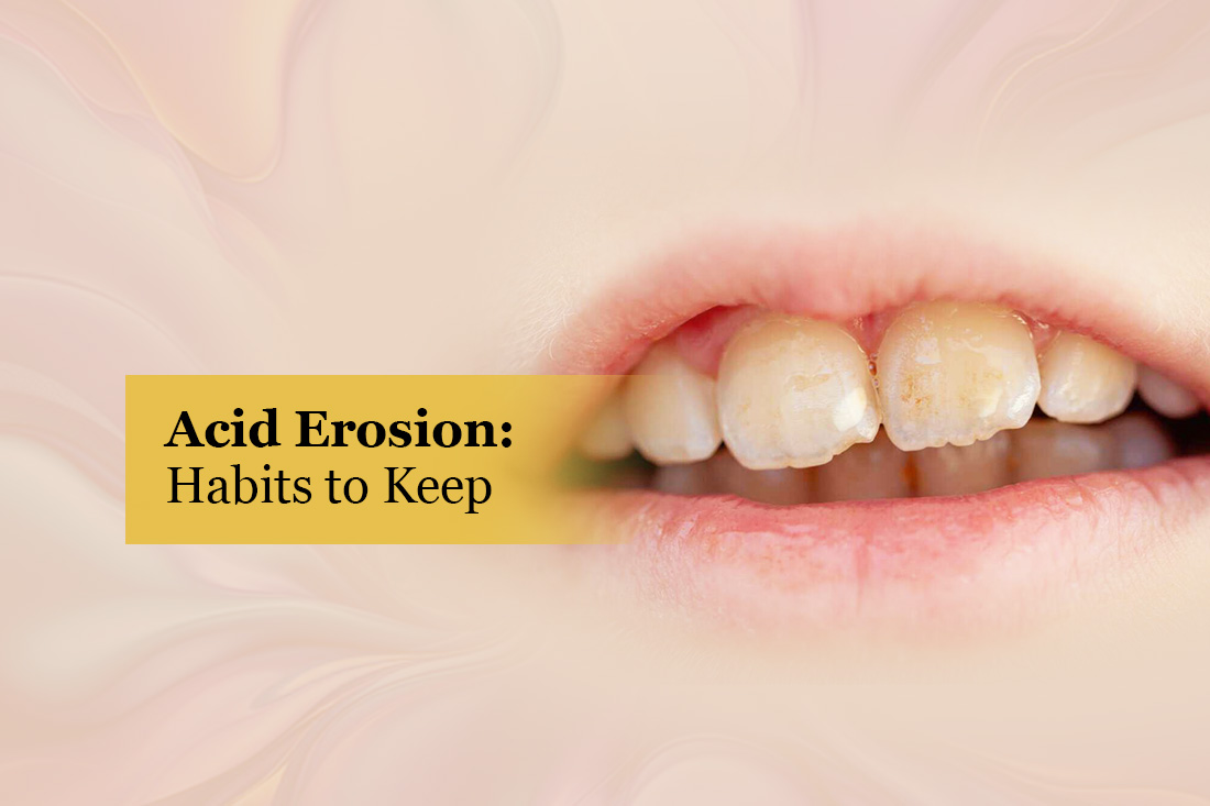 Close-up of a smile with worn, discolored front teeth, under the title Acid Erosion: Habits to Keep