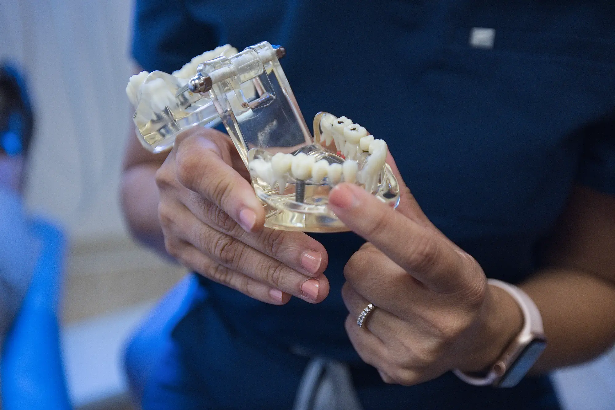 Dentist holding a clear model of an implant-supported bridge